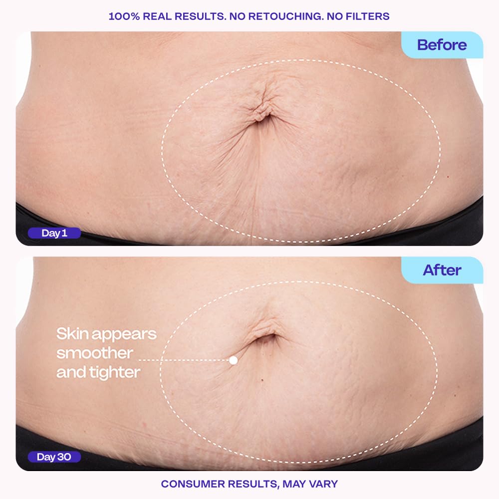 Smooth Skin Abdominal Cream